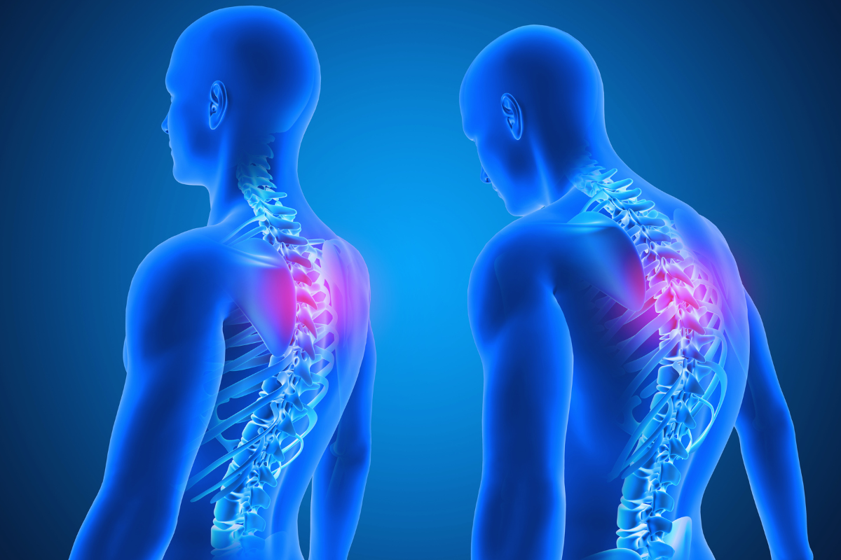 muscular imbalance problem